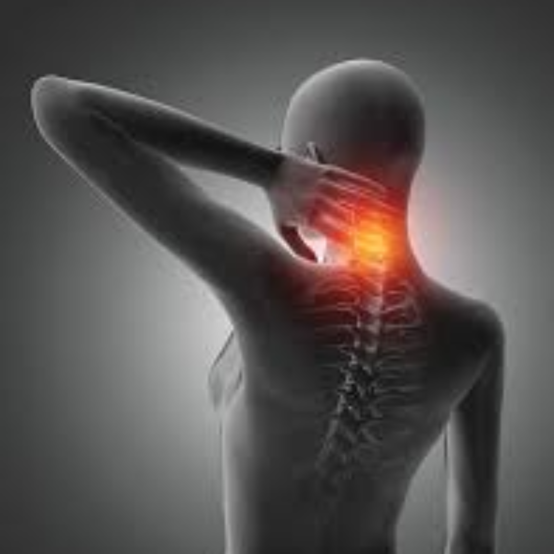 Cervical Spondylitis