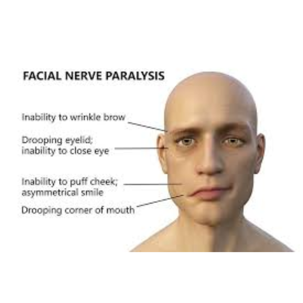 Facioscapulohumeral Muscular Dystrophy (FSHD)