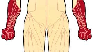 Distal Muscular Dystrophy (DMD)