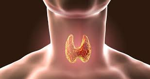 Hypothyroidism