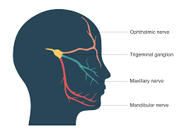 Trigeminal Neuralgia (TN)