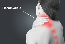 Fibromyalgia