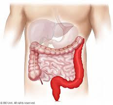 Crohn’s Disease (CD)